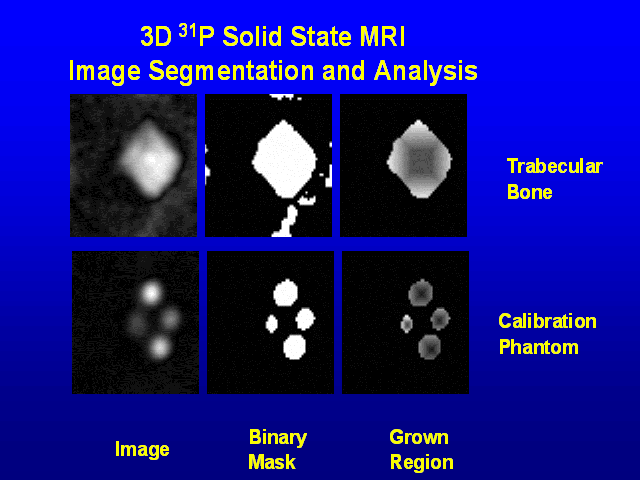 Example image: 31P image segmentation and region finding
