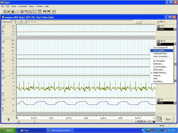 Getting to “GSR Amplifier” in chart 