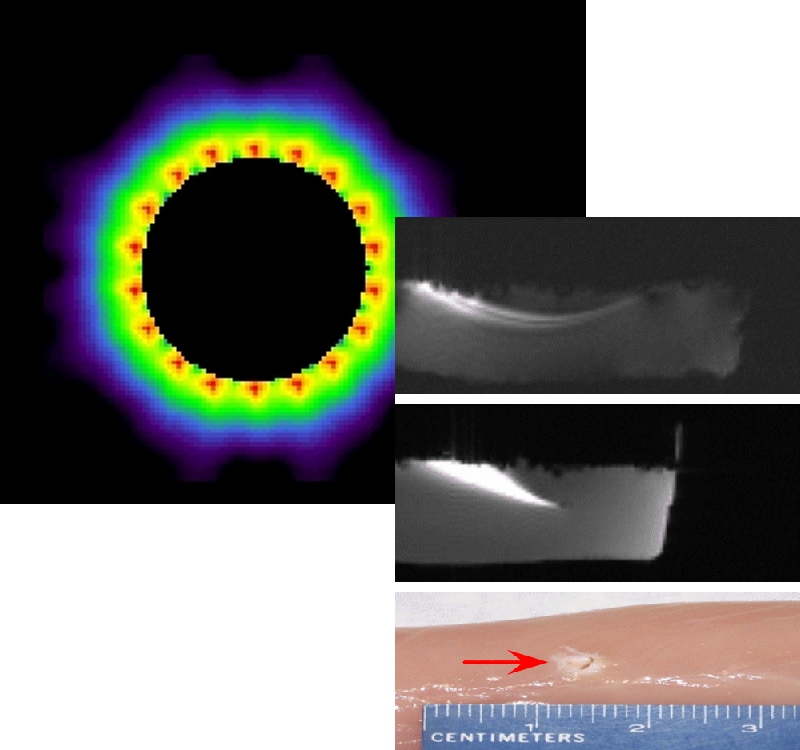 RF simulation and images