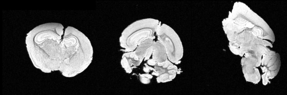 Fixed mouse brain 55 μm isotropic resolution 256^3 matrix (Ouri Cohen, Al Schroeder)