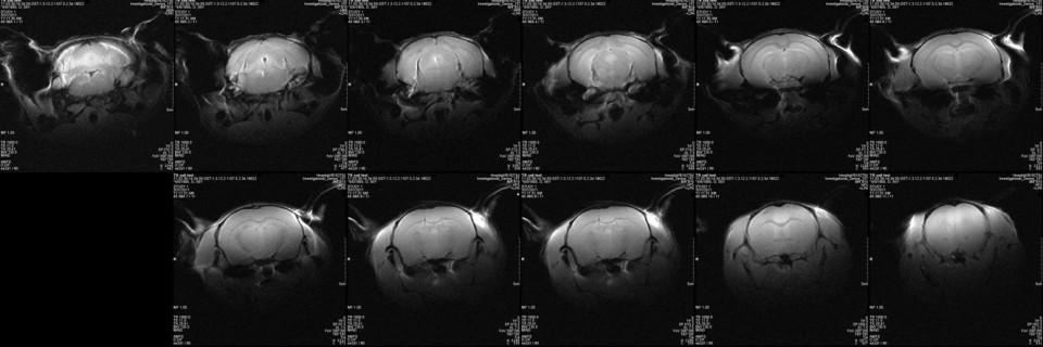 15T live mouse brain images (Shuning Huang, Iris Chen, George Dai)