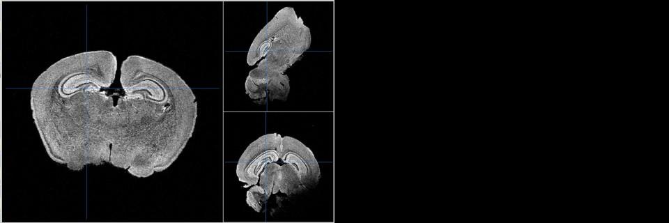 Fixed mouse brain 20 μm isotropic resolution 640^3 matrix (Ouri Cohen)