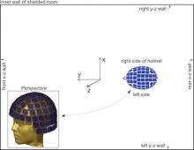 The measurement setup in the shielded MEG room