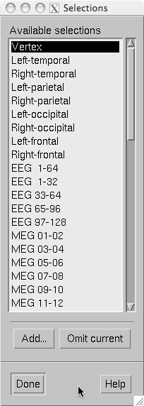 channel selection dialog