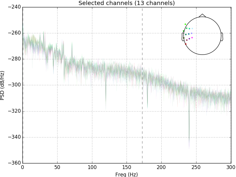 ../_images/sphx_glr_plot_artifacts_correction_filtering_002.png