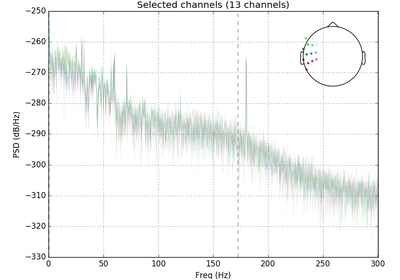 ../_images/sphx_glr_plot_artifacts_correction_filtering_thumb.png