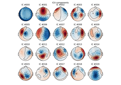 ../_images/sphx_glr_plot_artifacts_correction_ica_thumb.png