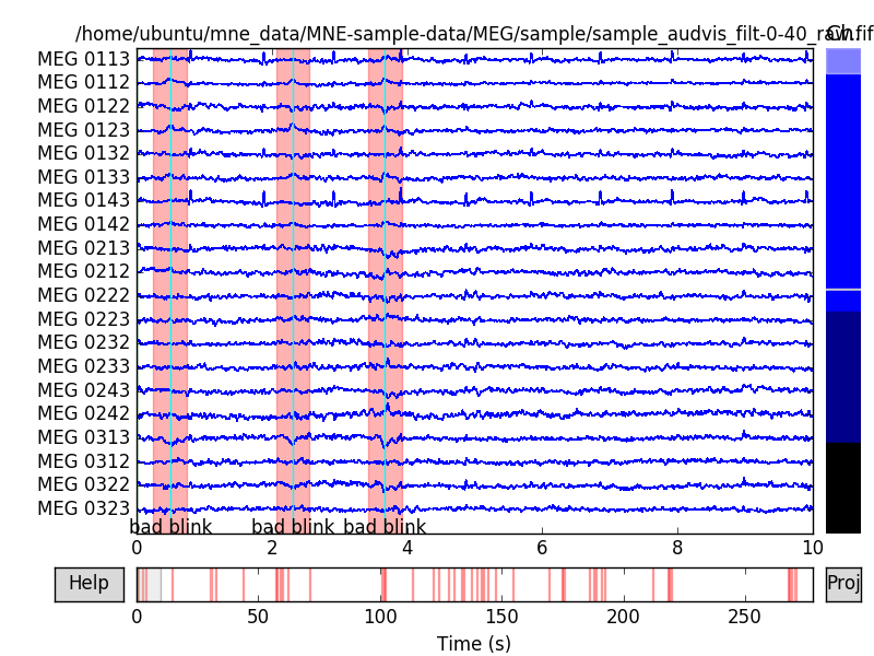 ../_images/sphx_glr_plot_artifacts_correction_rejection_003.png
