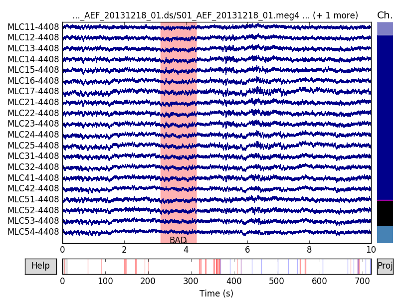 ../_images/sphx_glr_plot_brainstorm_auditory_001.png