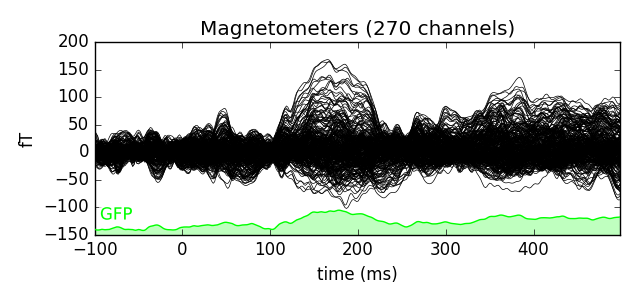 ../_images/sphx_glr_plot_brainstorm_auditory_006.png