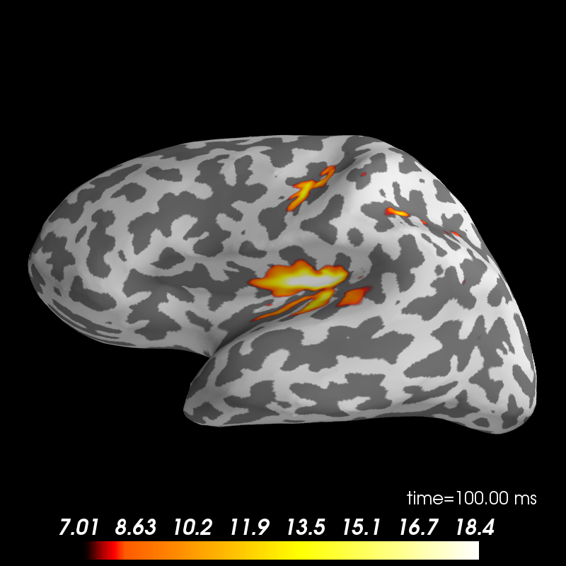 ../_images/sphx_glr_plot_brainstorm_auditory_010.png