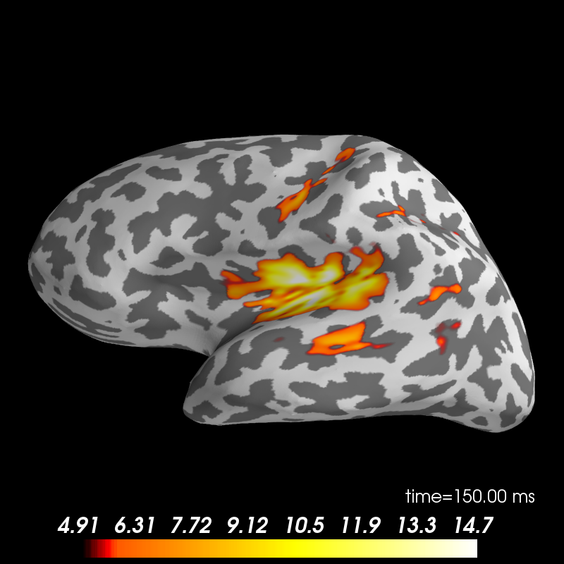 ../_images/sphx_glr_plot_brainstorm_auditory_011.png