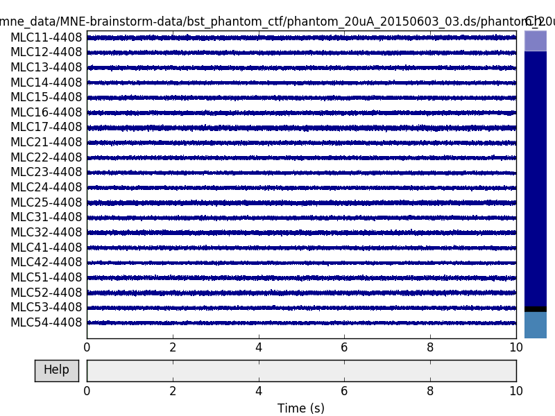../_images/sphx_glr_plot_brainstorm_phantom_ctf_002.png