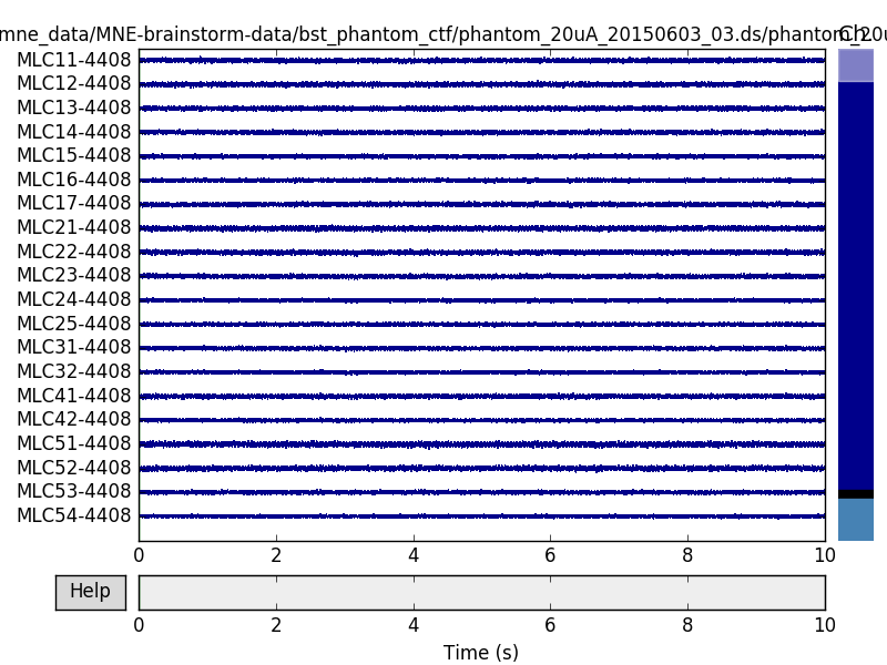 ../_images/sphx_glr_plot_brainstorm_phantom_ctf_003.png