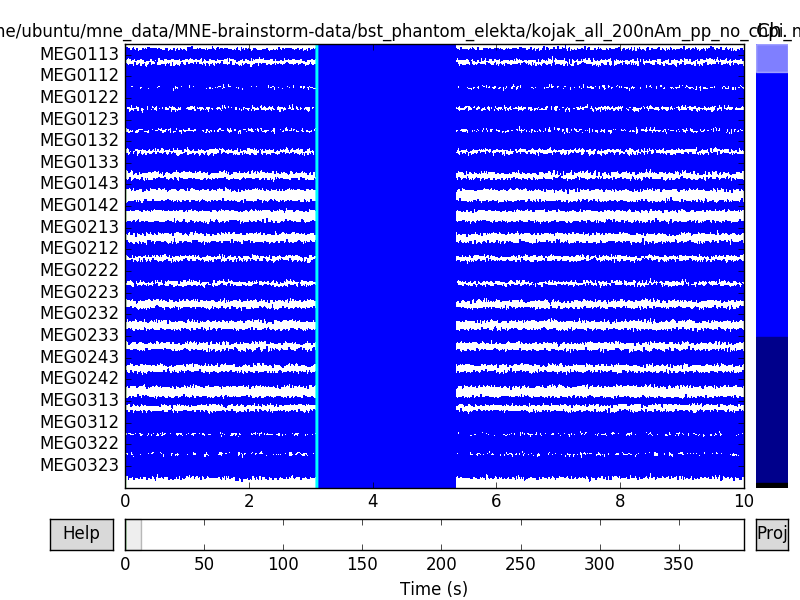 ../_images/sphx_glr_plot_brainstorm_phantom_elekta_001.png