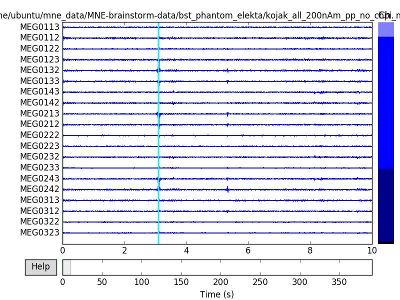 ../_images/sphx_glr_plot_brainstorm_phantom_elekta_003.png