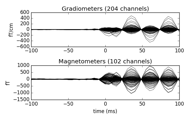 ../_images/sphx_glr_plot_brainstorm_phantom_elekta_004.png