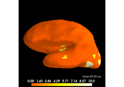 ../_images/sphx_glr_plot_decoding_spatio_temporal_source_thumb.png