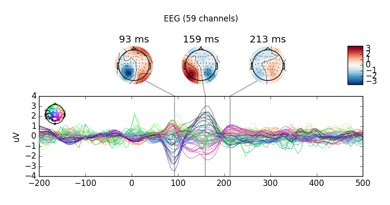../_images/sphx_glr_plot_eeg_erp_009.png