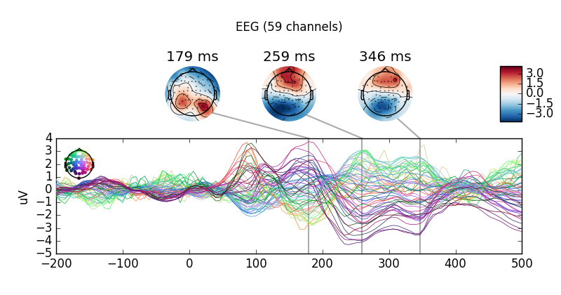 ../_images/sphx_glr_plot_eeg_erp_010.png
