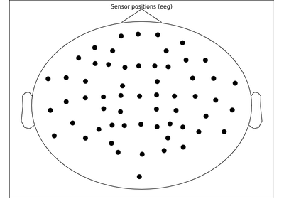 ../_images/sphx_glr_plot_eeg_erp_thumb.png