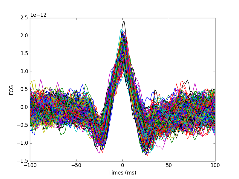 ../../_images/sphx_glr_plot_find_ecg_artifacts_001.png