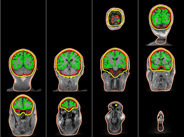 ../_images/sphx_glr_plot_forward_001.png