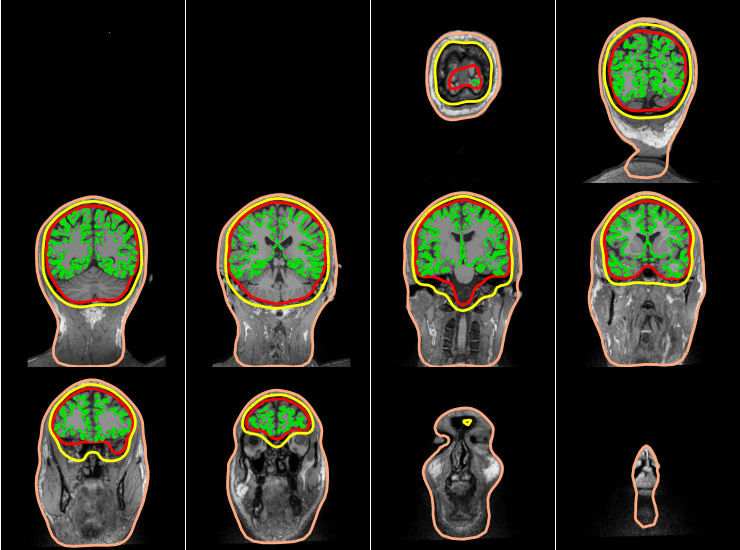 ../_images/sphx_glr_plot_forward_003.png