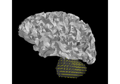 ../_images/sphx_glr_plot_left_cerebellum_volume_source_thumb.png