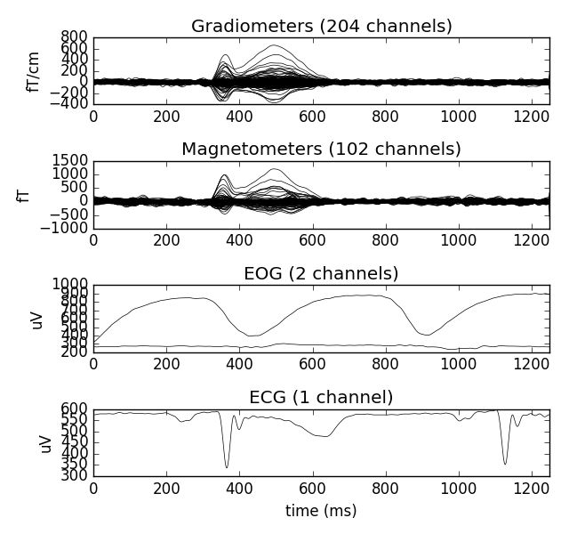 ../../_images/sphx_glr_plot_megsim_data_single_trial_001.png