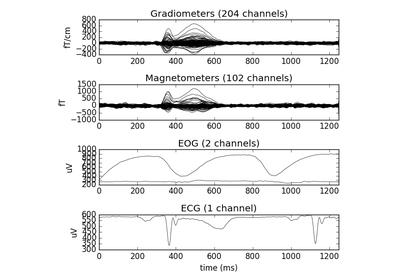 ../_images/sphx_glr_plot_megsim_data_single_trial_thumb.png