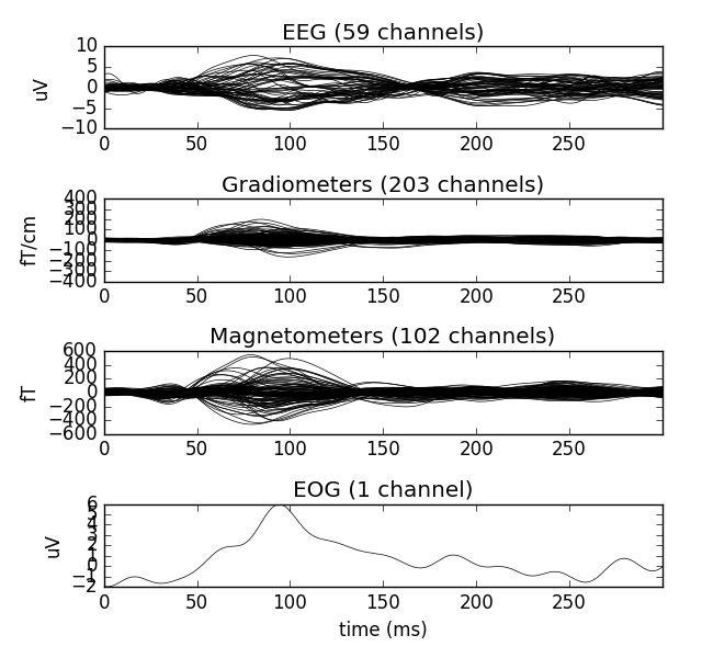 ../../_images/sphx_glr_plot_mixed_norm_inverse_001.png