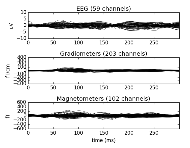 ../../_images/sphx_glr_plot_mixed_norm_inverse_002.png