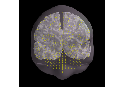../_images/sphx_glr_plot_mixed_source_space_inverse_thumb.png