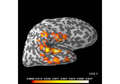 ../_images/sphx_glr_plot_mne_crosstalk_function_thumb.png