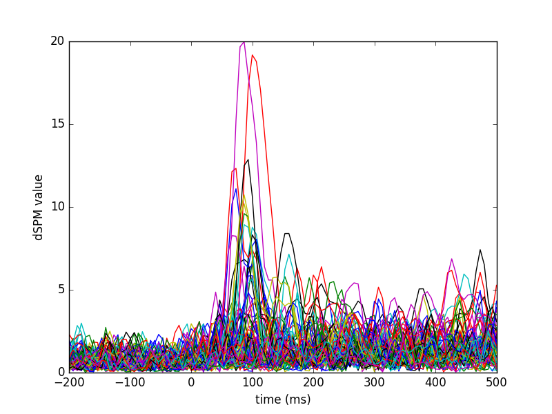 ../_images/sphx_glr_plot_mne_dspm_source_localization_006.png