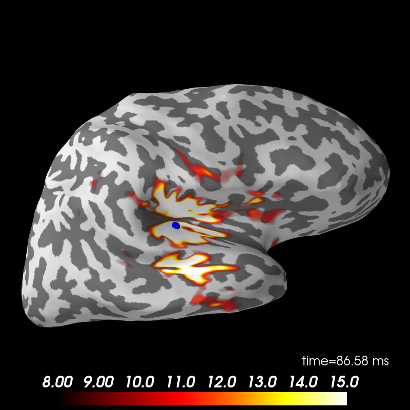 ../_images/sphx_glr_plot_mne_dspm_source_localization_007.png