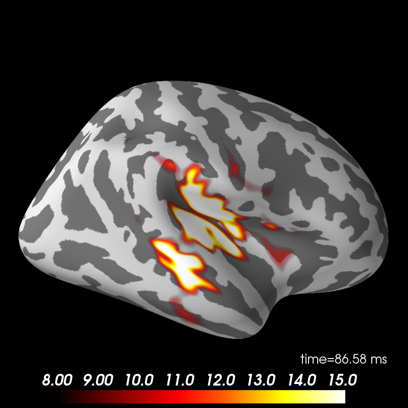 ../_images/sphx_glr_plot_mne_dspm_source_localization_008.png
