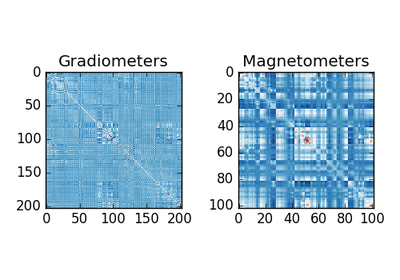../_images/sphx_glr_plot_mne_dspm_source_localization_thumb.png