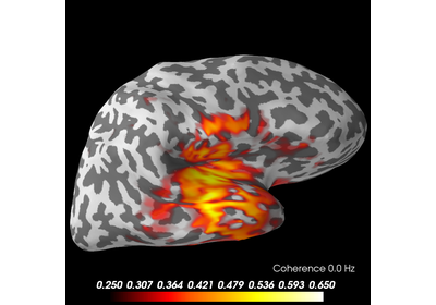 ../_images/sphx_glr_plot_mne_inverse_coherence_epochs_thumb.png