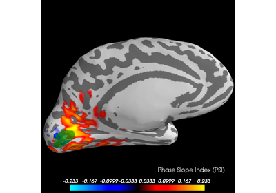 ../_images/sphx_glr_plot_mne_inverse_psi_visual_thumb.png