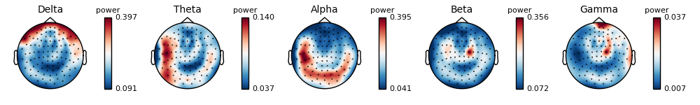 ../_images/sphx_glr_plot_sensors_time_frequency_002.png