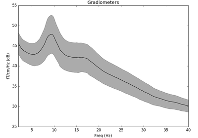 ../_images/sphx_glr_plot_sensors_time_frequency_thumb.png
