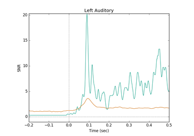 ../_images/sphx_glr_plot_snr_estimate_thumb.png