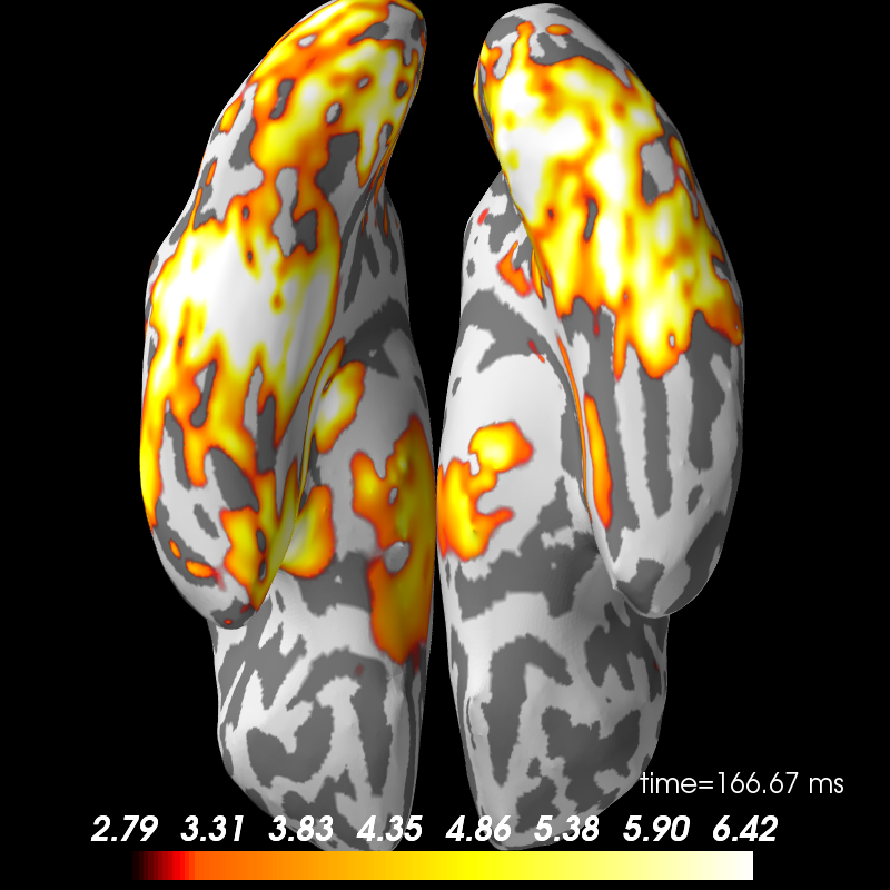 ../../_images/sphx_glr_plot_spm_faces_dataset_009.png
