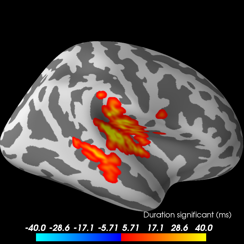 ../_images/sphx_glr_plot_stats_cluster_spatio_temporal_2samp_001.png