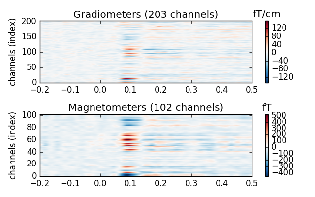 ../_images/sphx_glr_plot_visualize_evoked_011.png