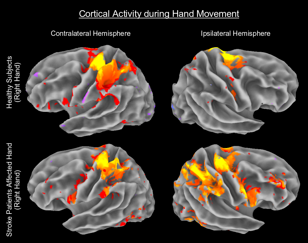 FMRI Data