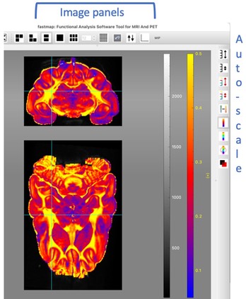 DTI-images