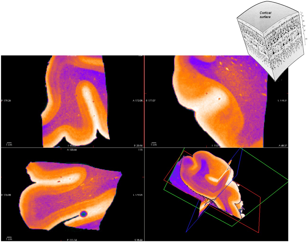 3D brain specimen MRI